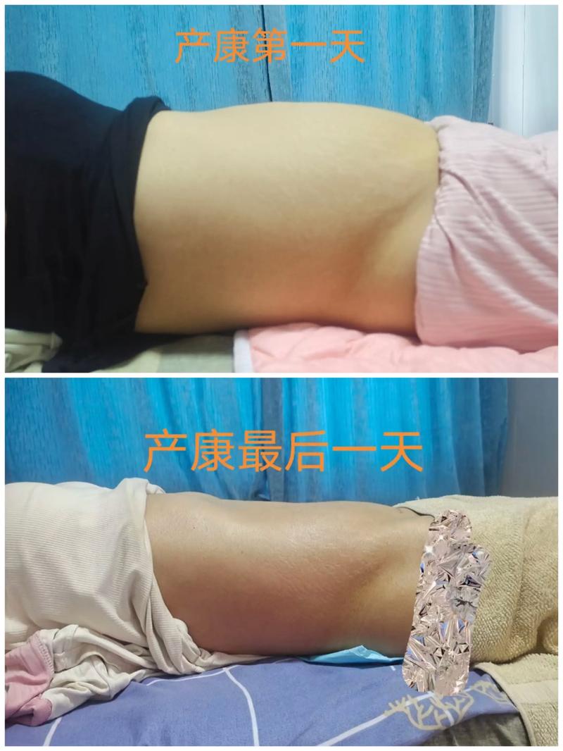母婴护理